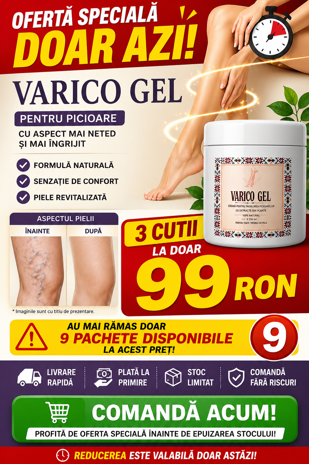 Varico Gel - Gel Revigorant pentru Picioare Obosite, Grele, Umflate, cu Varice
